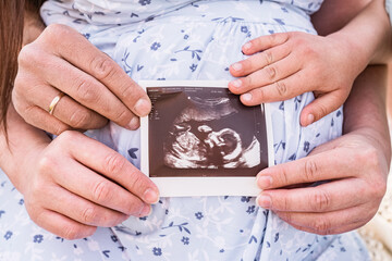 Baby ultrasound hold by family member's hands 