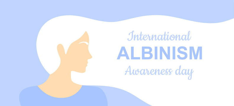 Albino woman with long hair on a soft blue background. International albinism awareness day