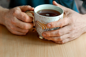 Male hands with vitiligo discoloration disease spotty loss of skin color , holding a gilded cup of hibiscus tea.