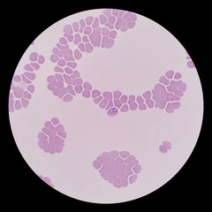 Babesia parasites inside red blood cell, the causative agent of babesiosis. Babesia canis is a...