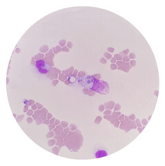 Phagocytosis of Babesia parasites by monocyte in canine blood, the causative agent of babesiosis....