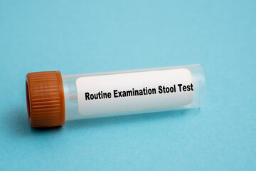 Routine Examination Stool Test