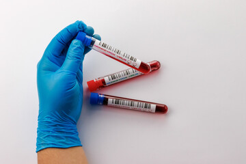 flasks with blood tests for monkey pox virus positive and negative