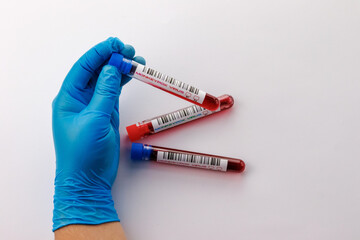 flasks with blood tests for monkey pox virus positive and negative