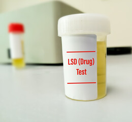 Urine sample for doping drug LSD test at medical laboratory for the detection of illegal drug LSD in human body.