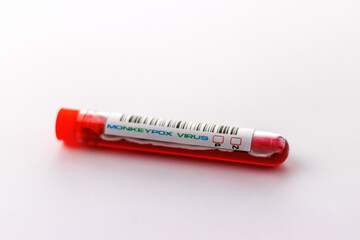 flasks with blood tests for monkey pox virus positive and negative