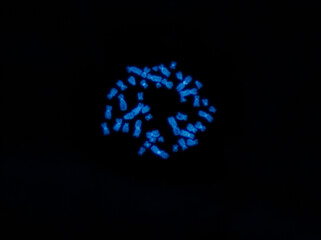 Chromosomes under fluorescence microscope, fluorescence in situ hybridization technique, Human...