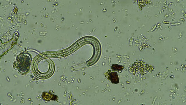 nematodes under the microscope in soil and compost