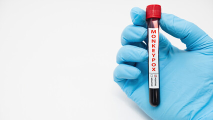 hand holding blood collection tubes on monkeypox test positive results in laboratories, white background.