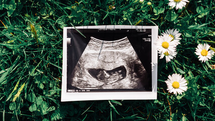 Ultrasound photo pregnancy baby. Ultrasound pregnancy picture on grass flowers background. Concept maternity, pregnancy, childbirth.