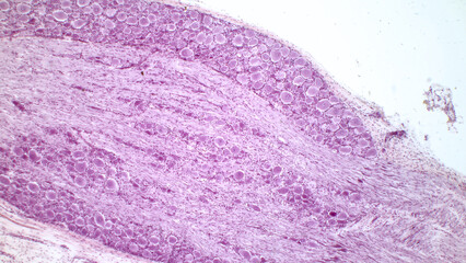 Dorsal root ganglion. Pseudounipolar neurons of a dorsal root ganglion. Hematoxlyn and eosin stain....