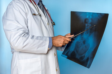 unrecognizable doctor pointing a metal pointer at a person's hip X-ray
