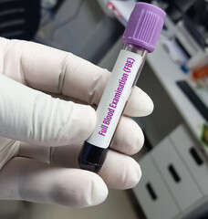 Test tube with blood sample for Full blood examination(FBE) test, Complete Blood Count, CBC test.