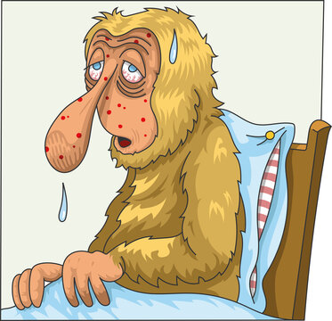 Epid&eacute;mie de variole du singe
