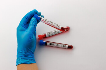flasks with blood tests for monkey pox virus positive and negative