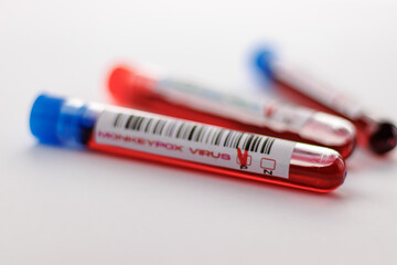flasks with blood tests for monkey pox virus positive and negative