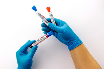 flasks with blood tests for monkey pox virus positive and negative