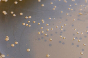 closeup photo of microorganisms colonies grown on agar media