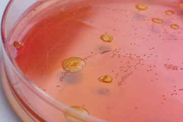 closeup photo of microorganisms colonies grown on agar media