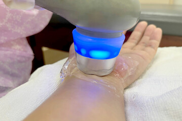 Treatment of hand and wrist injuries and numbness of the hands and nerves Method of treatment with ultrasound machine and gel therapy