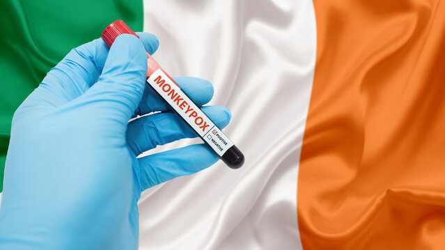 hand holding blood collection tubes on monkeypox virus test positive results with Ireland flag.