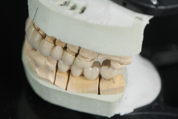 Metal free ceramic dental crowns.  Dental ceramic bridge on isolated wite background. Closeup ceramic to dental implants in laboratory.