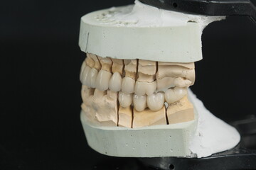 Metal free ceramic dental crowns.  Dental ceramic bridge on isolated wite background. Closeup ceramic to dental implants in laboratory.