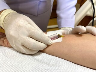 A nurse is collecting a blood sample, using a needle to draw a vein to take a blood sample from a patient.