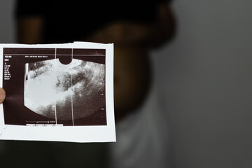 pregnant women sonogram with blurred background from flat angle
