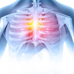 Painful rib anatomy, fractured ribs, pain highlighted in glowing red. 3d illustration