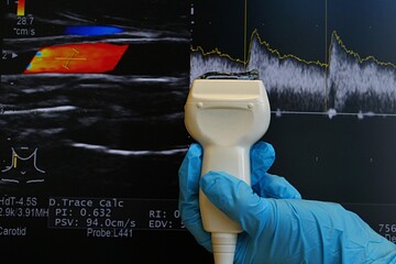 Modern ultrasound linear diagnostic probe held in left hand in blue sterile glove with conductive...