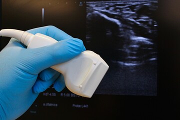 Modern linear ultrasound diagnostic probe held in doctor hand in blue glove, B-mode structure of wrist and median nerve for carpal tunnel syndrome diagnostics in background.