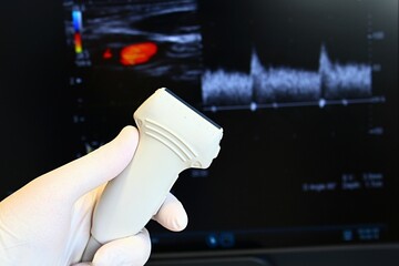 Modern ultrasound linear diagnostic probe held in left hand in blue sterile glove, carotic...