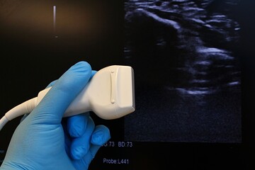 Modern linear ultrasound diagnostic probe held in doctor hand in blue glove, B-mode structure of...