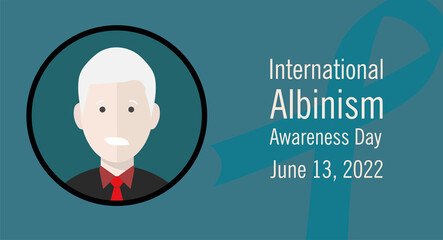 Illustration of Flat cartoon vector character. Illustration displays people pigmentation features. A man avatar with albinism. 13 June - the International Albinism Awareness Day.