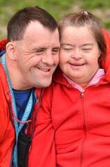 love couple with down syndrome