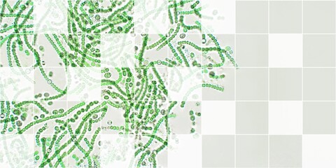 Nostoc sp. algae under microscopic view, cyanobacteria, Toxic water