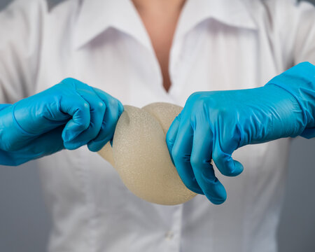 A plastic surgeon demonstrates the strength of silicone breast implants by squeezing them.
