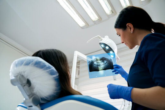 Dental teeth scan concept woman holding xray images on woman teeth 