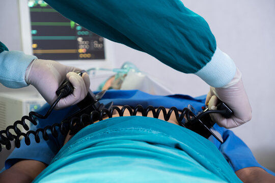 Doctor and nurse using defibrillator to pump at chest of unconscious with low heart rate patient to save life while doing medical surgery inside of operating room. Emergency aid, CPR.