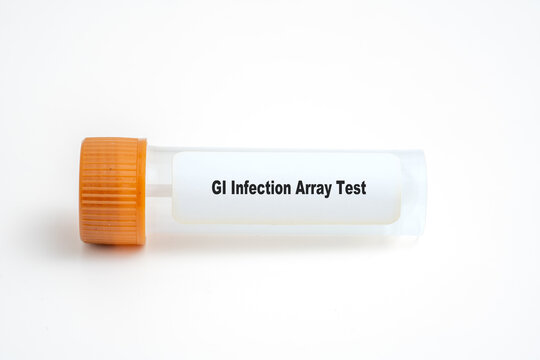 GI Infection Array Test