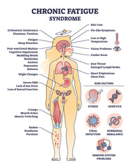 Chronic fatigue syndrome with symptom and risk factors list outline diagram. Labeled educational scheme with medical problem explanation and energy loss causes vector illustration. Tiredness effects.