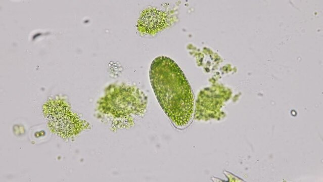 Bacteria and Protozoa in waste water under the microscope.