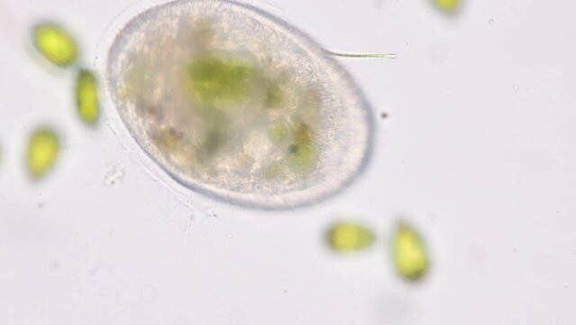 Bacteria and Protozoa in waste water under the microscope.