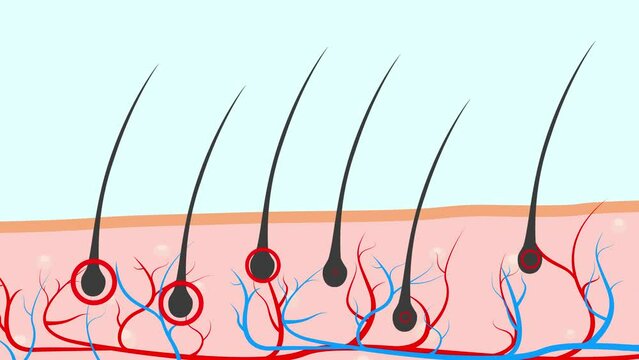 2D animation of hair loss proceeded by nutrient deficiency