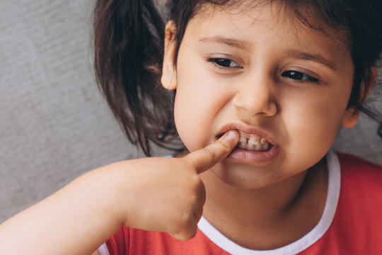 Little caucasian girl in a red dress shows pain in her tooth and mouth