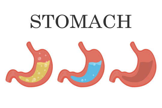 Healthy and unhealthy, empty and full human stomach, gastric juice reflux. Nutrition, stomach pain, bloating. Anatomy of the digestive system. Set of medical vector illustrations of the stomach isolat