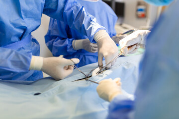 concentrated professional surgical doctor team operating surgery a patient in the operating room at the hospital. healthcare and medical concept. - obrazy, fototapety, plakaty