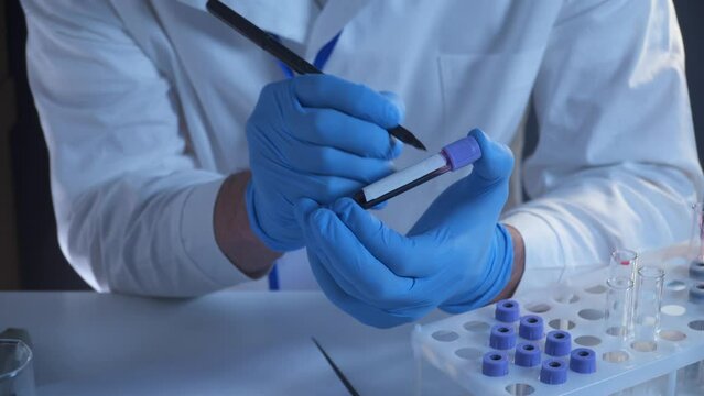 Lab technician does tests and analyses. Marker-signs thin tubes with blood samples. Wearing blue rubber gloves. Microbiological and chemical tests. The researcher labels the blood samples in the lab