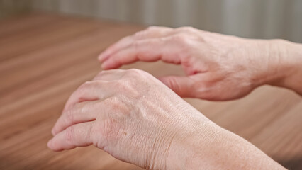 Old woman trembling hands due to Parkinson disease. Lady with shakiness holds wrinkled hands over...